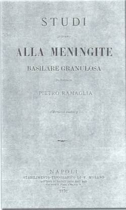 Studi sulla meningite